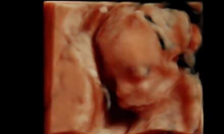 Planned Parenthood Leaders Admit Under Oath to Killing Babies in Illegal “Partial-Birth” organ harvesting Abortions